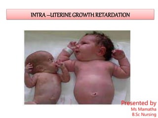 INTRA–UTERINE GROWTH RETARDATION
Presented by
Ms Mamatha
B.Sc Nursing
 