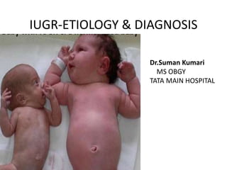 IUGR-ETIOLOGY & DIAGNOSIS
Dr.Suman Kumari
MS OBGY
TATA MAIN HOSPITAL
 