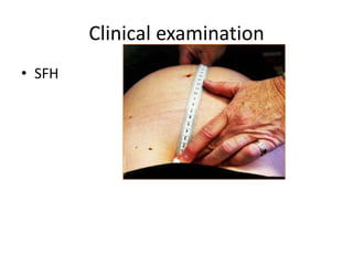 Clinical examination
• SFH
 