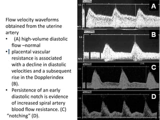 Flow velocity waveforms
obtained from the uterine
artery
• (A) high-volume diastolic
flow –normal
• placental vascular
resistance is associated
with a decline in diastolic
velocities and a subsequent
rise in the Dopplerindex
(B).
• Persistence of an early
diastolic notch is evidence
of increased spiral artery
blood flow resistance. (C)
“notching” (D).
 