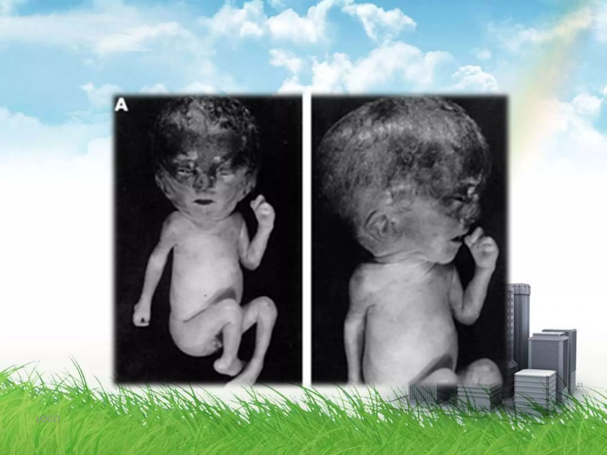 It may cause a proportionate reduction of both head and body size.LOGO