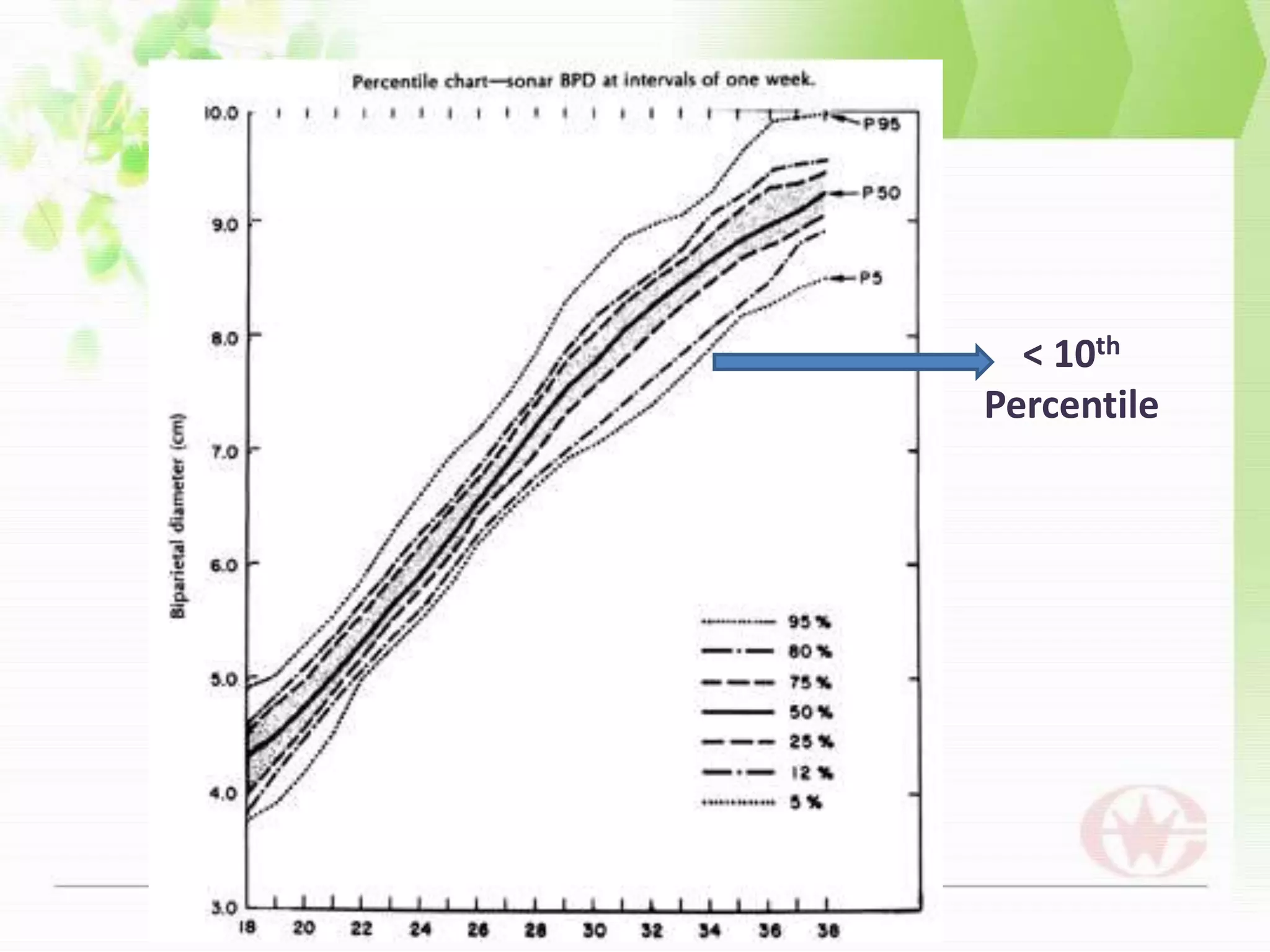 Trisomy 18,13 –severe IUGR