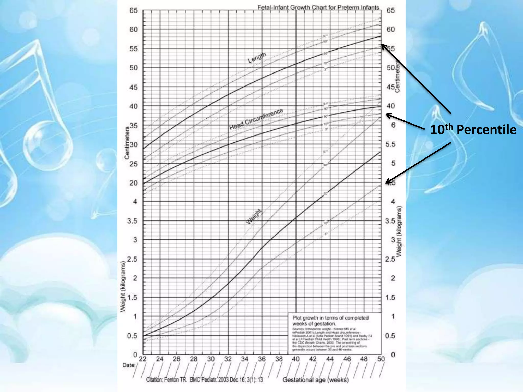Most common definition “ fetus weighing below 10th percentile for GA”(SGA)Other definition