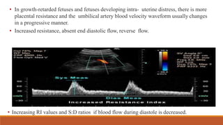 • In growth-retarded fetuses and fetuses developing intra- uterine distress, there is more
placental resistance and the umbilical artery blood velocity waveform usually changes
in a progressive manner.
• Increased resistance, absent end diastolic flow, reverse flow.
• Increasing RI values and S:D ratios if blood flow during diastole is decreased.
 