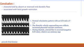 :
– characterized by absent or reversed end-diastolic flow
– associated with fetal growth restriction
A. Normal velocimetry pattern with an S/D ratio of <
3.0
B. The diastolic velocity approaching zero reflects
increased placental vascular resistance.
C. During diastole, arterial flow is reversed (negative
S/D ratio), which is an ominous sign
precede fetal demise
 