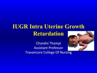 IUGR Intra Uterine Growth
Retardation
Chandni Thampi
Assistant Professor
Travancore College Of Nursing
 