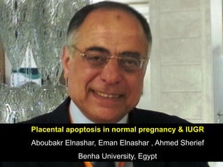 Placental apoptosis in normal pregnancy & IUGR
Aboubakr Elnashar, Eman Elnashar , Ahmed Sherief
Benha University, Egypt
 
