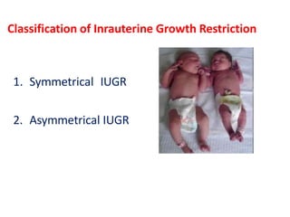 Classification of Inrauterine Growth Restriction
1. Symmetrical IUGR
2. Asymmetrical IUGR
 