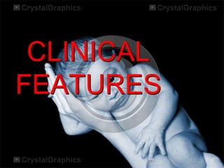 CLINICAL
FEATURES

 