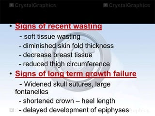 • Signs of recent wasting
- soft tissue wasting
- diminished skin fold thickness
- decrease breast tissue
- reduced thigh circumference

• Signs of long term growth failure
- Widened skull sutures, large
fontanelles
- shortened crown – heel length
- delayed development of epiphyses

 