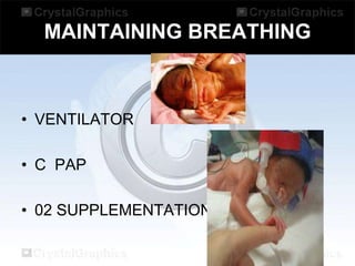MAINTAINING BREATHING

• VENTILATOR
• C PAP

• 02 SUPPLEMENTATION

 