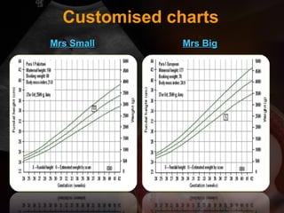 Customised charts
Mrs SmallMrs Small Mrs BigMrs Big
 