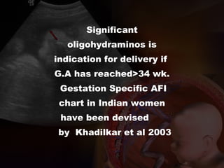 Significant
oligohydraminos is
indication for delivery if
G.A has reached>34 wk.
Gestation Specific AFI
chart in Indian women
have been devised
by Khadilkar et al 2003
 