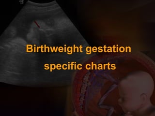 Birthweight gestation
specific charts
 
