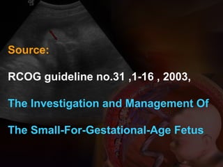 Source:
RCOG guideline no.31 ,1-16 , 2003,
The Investigation and Management Of
The Small-For-Gestational-Age Fetus
 