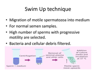 Swim Up technique
• Migration of motile spermatozoa into medium
• For normal semen samples.
• High number of sperms with progressive
motility are selected.
• Bacteria and cellular debris filtered.
 
