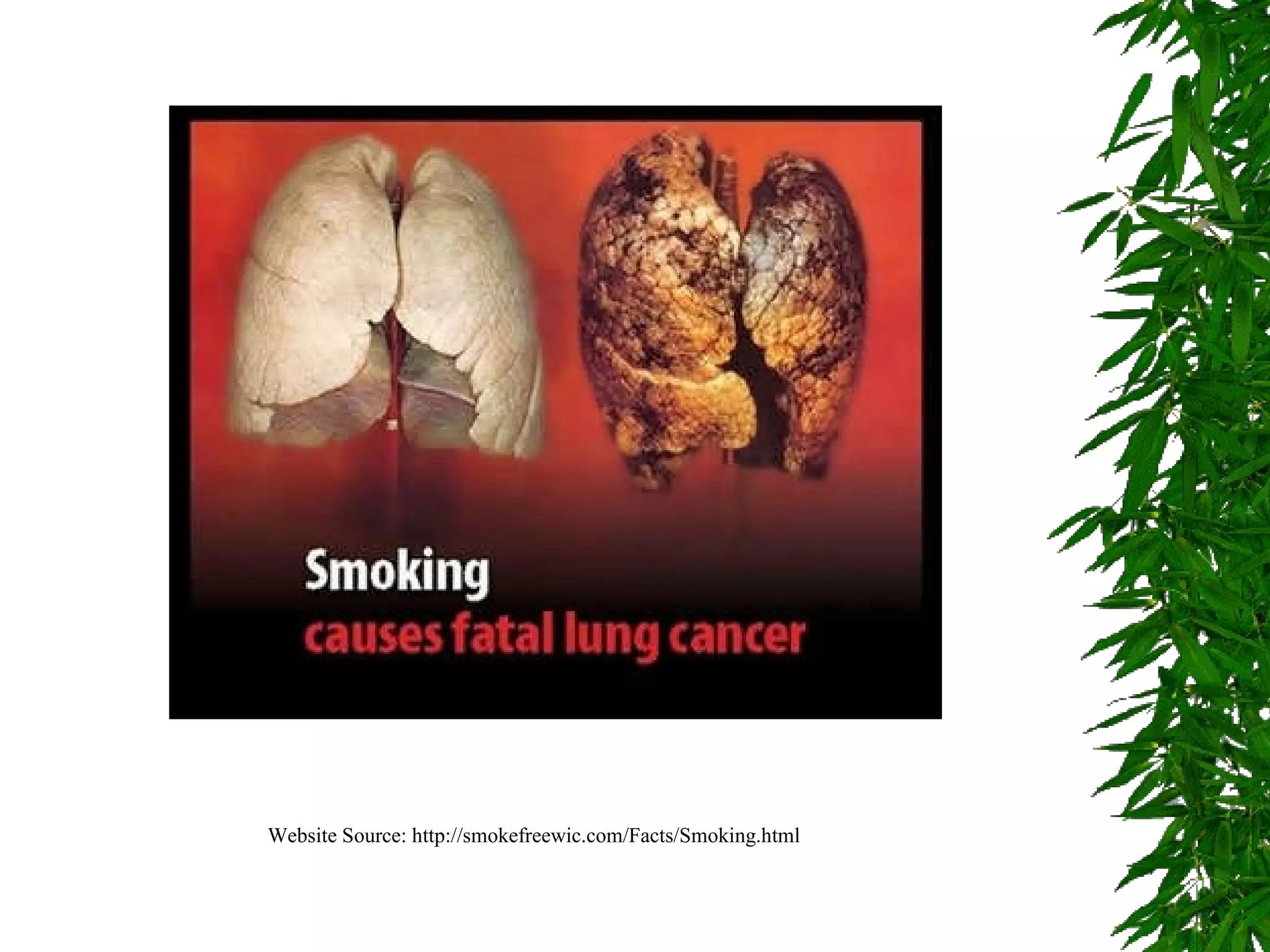 Website Source: http://smokefreewic.com/Facts/Smoking.html 
