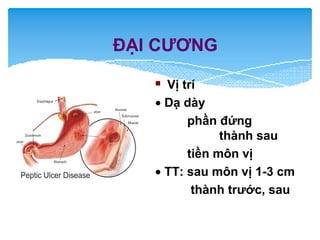 ĐẠI CƯƠNG
 Vị trí
• Dạ dày
phần đứng
thành sau
tiền môn vị
• TT: sau môn vị 1-3 cm
thành trước, sau
 