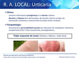 R. A. LOCAL: Urticaria
Manejo perioperatorio del Shock Anafiláctico.
Sesión clínica. Servicio de Anestesiología y Reanimación. HCU Valladolid. Alejandra Fadrique Fuentes
• Clínica:
Lesiones inflamatorias pruriginosas en la dermis cutánea.
Ronchas y habones bien demarcados, de tamaño y forma variable, de
localización cambiante y evanescentes (no dejan lesión residual).
• Fisiopatología:
Aumento de la permeabilidad vascular por liberación de mediadores: Histamina,
complemento (C3a Y C5a), leucotrienos, prostaglandinas…
Triple respuesta de Lewis: Eritema + Edema + Calor local
 