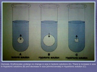 Osmosis. Erythrocytes undergo no change in size in Isotonic solutions (A). There is increase in size in Hypotonic solutions (B) and decrease in size [shrink/crenate] in Hypertonic solution (C).  