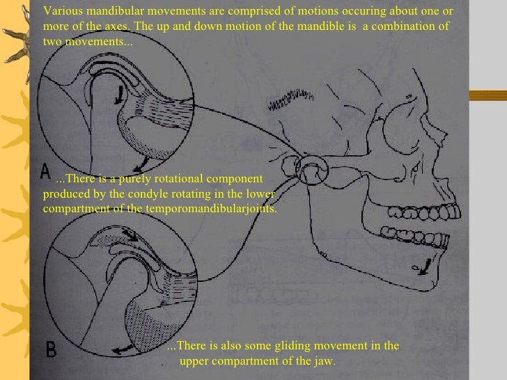 Iv.tooth prep v. occlusion