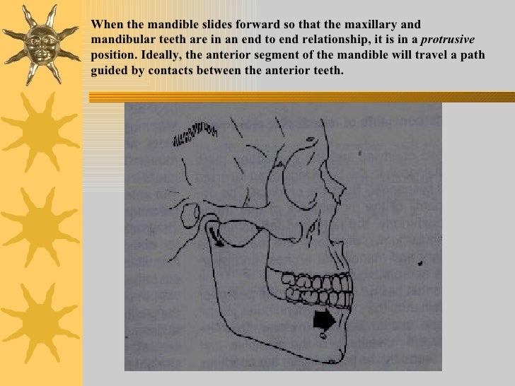 Iv.tooth prep v. occlusion