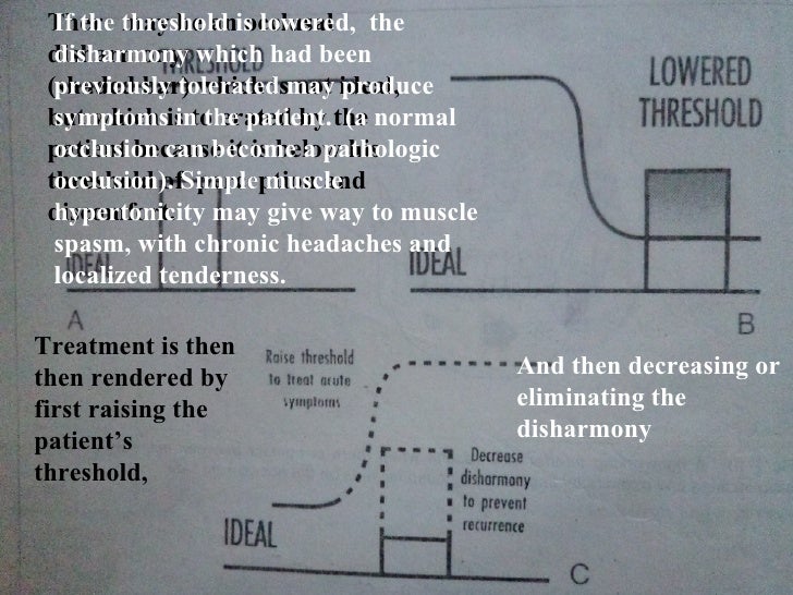 Iv.tooth prep v. occlusion