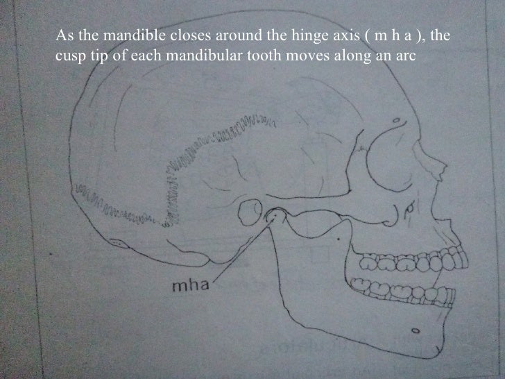 Iv.tooth prep v. occlusion