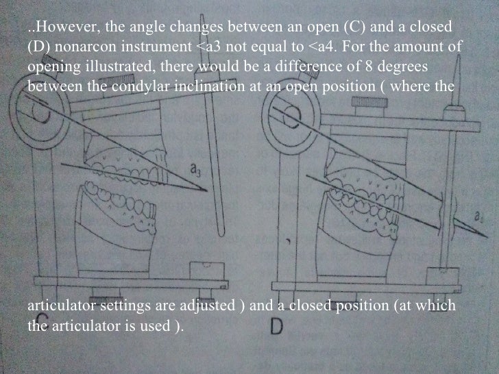 Iv.tooth prep v. occlusion