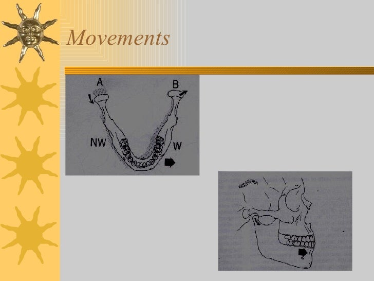 Iv.tooth prep v. occlusion