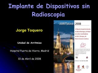 Implante de Dispositivos sin Radioscopia   Unidad de Arritmias Hospital Puerta de Hierro. Madrid 10 de Abril de 2008 Jorge Toquero 