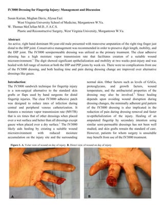 IV3000 Dressing for Fingertip Injury: Management and Discussion
Susan Kurian, Meghan Davis, Alyssa Fazi
West Virginia University School of Medicine, Morgantown W.Va.
W. Thomas McClellan M.D., F.A.C.S.
Plastic and Reconstructive Surgery, West Virginia University, Morgantown W.Va.
Abstract:
An active, right hand dominant 86-year-old male presented with transverse amputation of the right ring finger just
distal to the DIP joint. Conservative management was recommended in order to preserve digit length, mobility, and
the DIP joint. The IV3000 semipermeable dressing was utilized as the primary treatment. The clear adhesive
dressing has a high moisture vapor transmission rate that facilitates creation of a suitable wound
microenvironment.1
The digit showed significant epithelialization and mobility at two weeks post-injury and was
healed with full range of motion at both the DIP and PIP joints by week six. There were no complications from use
of the IV3000 dressing, and both healing time and pain during dressing change are improved over alternative
dressings like gauze.
Introduction:
The IV3000 sandwich technique for fingertip injury
is a non-surgical alternative to the standard skin
grafts or flaps used by hand surgeons for distal
fingertip injuries. The clear IV3000 adhesive patch
was designed to reduce rates of infection during
central and peripheral venous catheterization. It
features a moisture vapor transmission rate (MVTR)
that is six times that of other dressings when placed
over a wet surface and better than all dressings except
gauze when placed over a dry surface.1
The IV3000
likely aids healing by creating a suitable wound
microenvironment with reduced moisture
accumulation on the injury site and the surrounding
normal skin. Other factors such as levels of GAGs,
proteoglycans, and growth factors, wound
temperature, and the antibacterial properties of the
dressing may also be involved.2
Since healing
depends upon avoiding wound disruption during
dressing changes, the minimally adherent grid pattern
of the IV3000 dressing is also implicated in the
reduction of pain during dressing removal and faster
re-epithelialization of the injury. Healing of an
amputated fingertip by secondary intention using
similar semi-permeable dressings has not been well
studied, and skin grafts remain the standard of care.
However, patients for whom surgery is unsuitable
may benefit from use of the IV3000 treatment.
Figure 1. A. Volar view of wound on day of injury. B. Direct view of wound on day of injury
A B
 