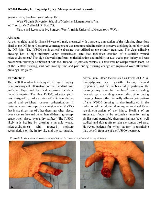 IV 3000 An Innovative Fingertip Dressing