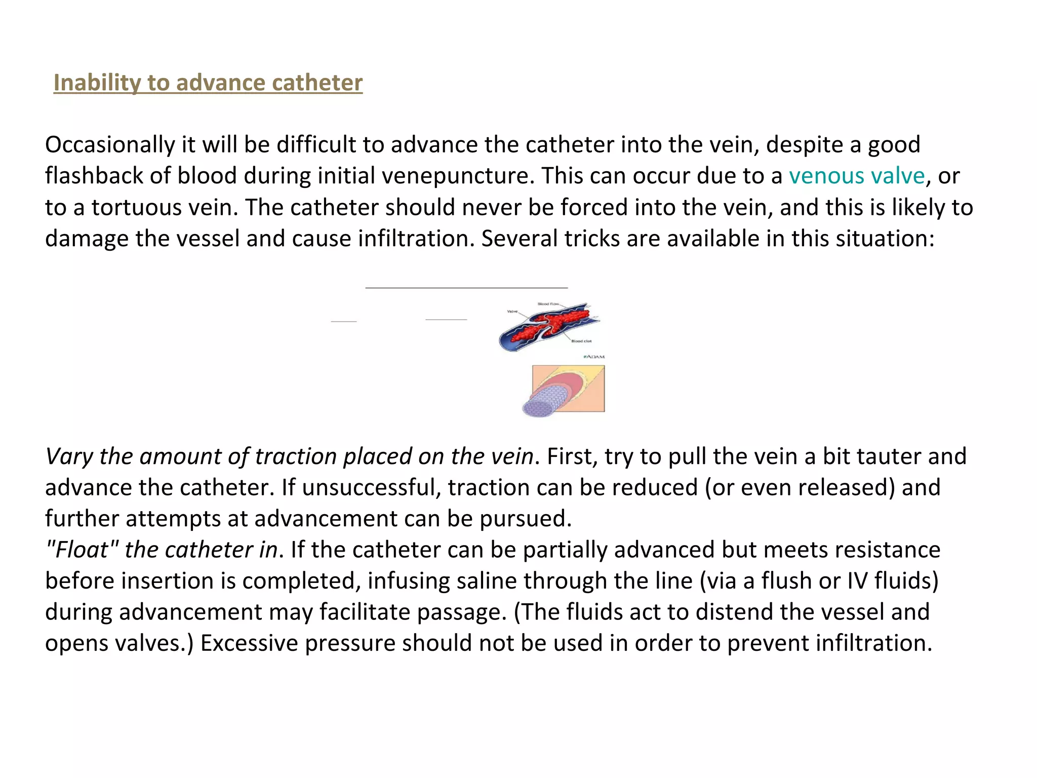 Inability to advance catheter

Occasionally it will be difficult to advance the catheter into the vein, despite a good
flashback of blood during initial venepuncture. This can occur due to a venous valve, or
to a tortuous vein. The catheter should never be forced into the vein, and this is likely to
damage the vessel and cause infiltration. Several tricks are available in this situation:




Vary the amount of traction placed on the vein. First, try to pull the vein a bit tauter and
advance the catheter. If unsuccessful, traction can be reduced (or even released) and
further attempts at advancement can be pursued.
"Float" the catheter in. If the catheter can be partially advanced but meets resistance
before insertion is completed, infusing saline through the line (via a flush or IV fluids)
during advancement may facilitate passage. (The fluids act to distend the vessel and
opens valves.) Excessive pressure should not be used in order to prevent infiltration.
 