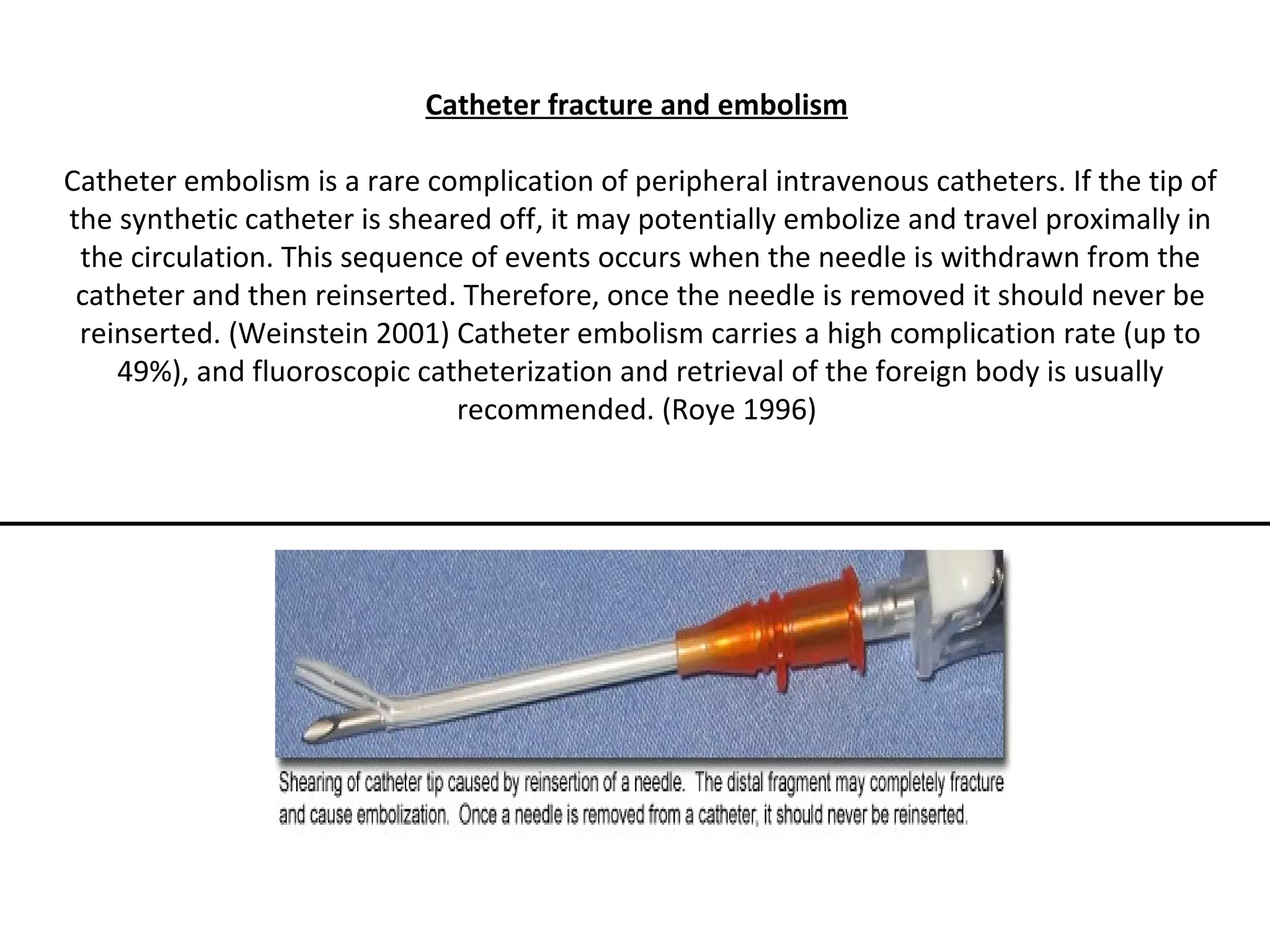 Catheter fracture and embolism

    Catheter embolism is a rare complication of peripheral intravenous catheters. If the tip of
    the synthetic catheter is sheared off, it may potentially embolize and travel proximally in
     the circulation. This sequence of events occurs when the needle is withdrawn from the
     catheter and then reinserted. Therefore, once the needle is removed it should never be
     reinserted. (Weinstein 2001) Catheter embolism carries a high complication rate (up to
        49%), and fluoroscopic catheterization and retrieval of the foreign body is usually
                                   recommended. (Roye 1996)

 
 