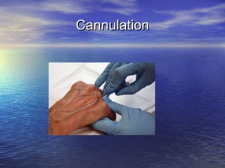 CannulationCannulation
 