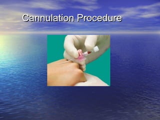 Cannulation ProcedureCannulation Procedure
 