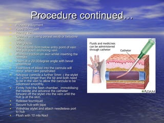 Procedure continued…Procedure continued…
• Prepare equipmentPrepare equipment
• Apply tourniquetApply tourniquet
• Identify veinIdentify vein
• Cleanse site using persist swab or betadineCleanse site using persist swab or betadine
swabswab
• Don glovesDon gloves
• Place thumb 5cm below entry point of veinPlace thumb 5cm below entry point of vein
and pull down anchoring veinand pull down anchoring vein
• Maintain traction on skin whilst inserting theMaintain traction on skin whilst inserting the
cannulacannula
• Insert at a 20-30degree angle with bevelInsert at a 20-30degree angle with bevel
uppermostuppermost
• Flashback of blood into the cannula willFlashback of blood into the cannula will
occur when vein penetratedoccur when vein penetrated
• Advance cannula a further 5mm .( the styletAdvance cannula a further 5mm .( the stylet
is 1-2mm longer than the tip and both needis 1-2mm longer than the tip and both need
to be in the vein to allow the cannula to beto be in the vein to allow the cannula to be
advanced smoothly.advanced smoothly.
• Firmly hold the flash chamber, immobilisingFirmly hold the flash chamber, immobilising
the needle and advance the catheterthe needle and advance the catheter
forward off the stylet into the vein until theforward off the stylet into the vein until the
hub is at the skin.hub is at the skin.
• Release tourniquetRelease tourniquet
• Secure hub with tapeSecure hub with tape
• Withdraw stylet and attach needleless portWithdraw stylet and attach needleless port
to hubto hub
• Flush with 10 mls NaclFlush with 10 mls Nacl
 