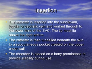 InsertionInsertion
• The catheter is inserted into the subclavian,The catheter is inserted into the subclavian,
jugular or cephalic vein and worked through tojugular or cephalic vein and worked through to
the lower third of the SVC. The tip must liethe lower third of the SVC. The tip must lie
above the right atriumabove the right atrium
• The catheter is then tunnelled beneath the skinThe catheter is then tunnelled beneath the skin
to a subcutaneous pocket created on the upperto a subcutaneous pocket created on the upper
chest wall.chest wall.
• The chamber is placed on a bony prominence toThe chamber is placed on a bony prominence to
provide stability during useprovide stability during use
 