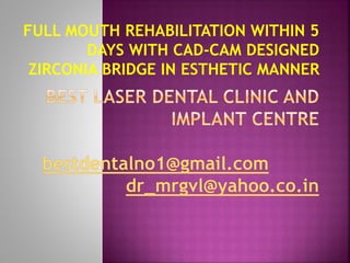 FULL MOUTH REHABILITATION WITHIN 5
DAYS WITH CAD-CAM DESIGNED
ZIRCONIA BRIDGE IN ESTHETIC MANNER
 