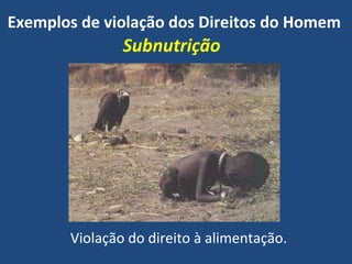 Subnutrição Violação do direito à alimentação. Exemplos de violação dos Direitos do Homem 
