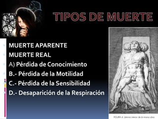 TIPOS DE MUERTEMUERTE APARENTEMUERTE REALA) Pérdida de ConocimientoB.- Pérdida de la MotilidadC.- Pérdida de la SensibilidadD.- Desaparición de la Respiración