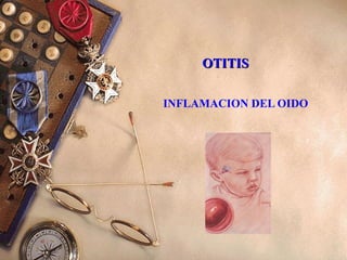 OTITISOTITIS
INFLAMACION DEL OIDO
 