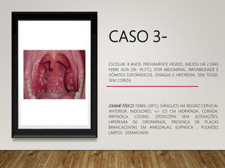 CASO 3-
ESCOLAR, 8 ANOS. PREVIAMENTE HÍGIDO,. INICIOU HÁ 2 DIAS
FEBRE ALTA (38- 39,5°C), DOR ABDOMINAL, IRRITABILIDADE E
VÔMITOS ESPORÁDICOS. DISFAGIA E HIPOREXIA. SEM TOSSE,
SEM CORIZA.
EXAME FÍSICO: FEBRIL (39°C), GÂNGLIOS NA REGIÃO CERVICAL
ANTERIOR, INDOLORES, +/- 0,5 CM HIDRATADA, CORADA,
IRRITADIÇA. COONG: OTOSCOPIA SEM ALTERAÇÕES,
HIPEREMIA DE OROFARINGE, PRESENÇA DE PLACAS
BRANCACENTAS EM AMIGDALAS. EUPNEICA , PULMÕES
LIMPOS . DEMAIS:NDN
 
