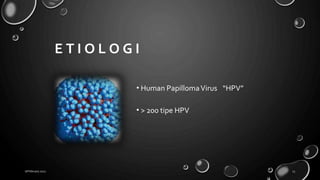 E T I O L O G I
• Human PapillomaVirus “HPV”
• > 200 tipe HPV
18 February 2022 13
 