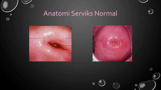 Anatomi Serviks Normal
 
