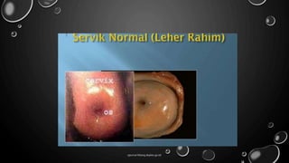 ejournal.litbang.depkes.go.id/
 