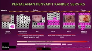 PERJALANAN PENYAKIT KANKER
Bulan
SERVIKS
Tahun
Waktu
NIS II NIS III
Normal
epithelium
NIS I KANKER
SERVIKS
HPV infection;
koilocytosis
High grade squamous intraepithelial lesion
(HSIL)
Low grade squamous intraepithelial
lesion (ASCUS/LSIL)
From incident to persistent HPV infection
Spontaneous regression
Terapi
Skrining
 