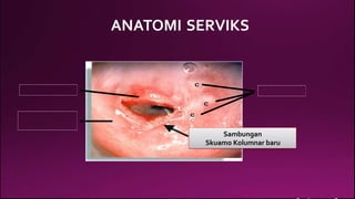 ANATOMI SERVIKS
Sambungan
Skuamo Kolumnar baru
 