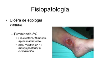 Fisiopatología Ulcera de etiología venosa Prevalencia 3% Sin cicatrizar 9 meses aproximadamente 80% recidiva en 12 meses posterior a cicatrización 